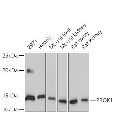 Human EG-VEGF/PK1 Rabbit Monoclonal Antibody