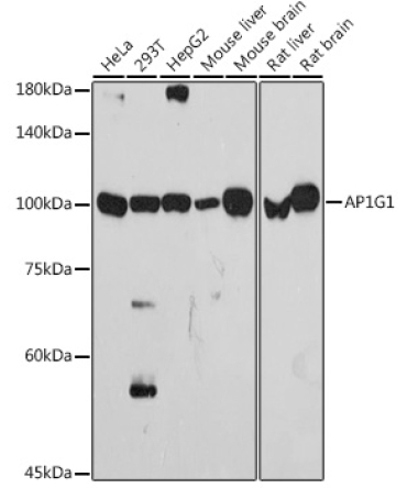 AP1G1 Rabbit Monoclonal Antibody
