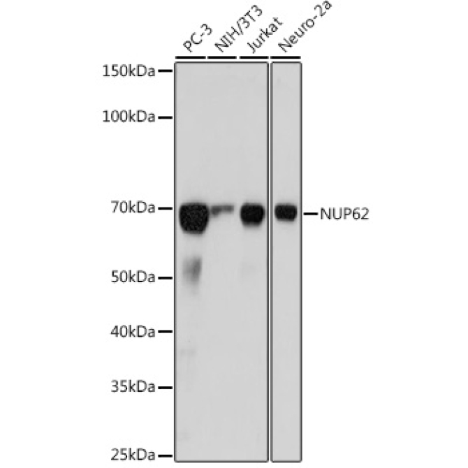 NUP62 Rabbit Monoclonal Antibody