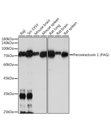 PAG1 Rabbit Monoclonal Antibody