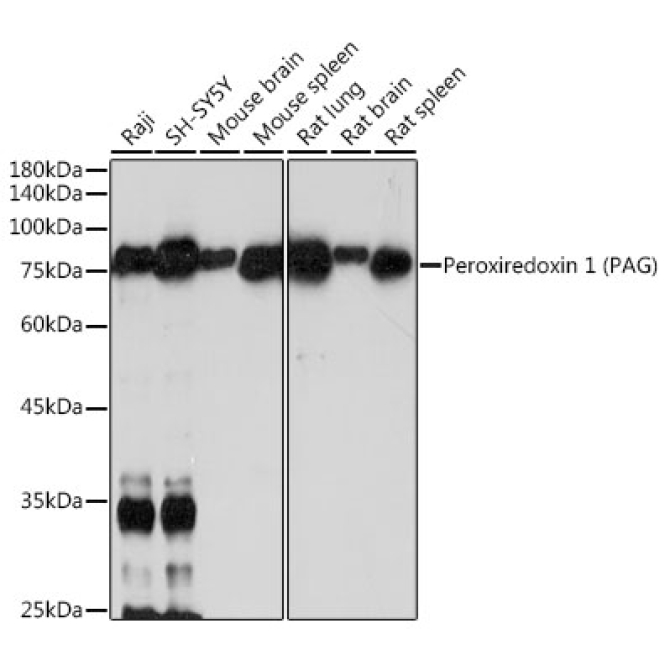 PAG1 Rabbit Monoclonal Antibody