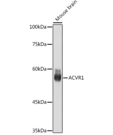ACVR1 Rabbit Monoclonal Antibody