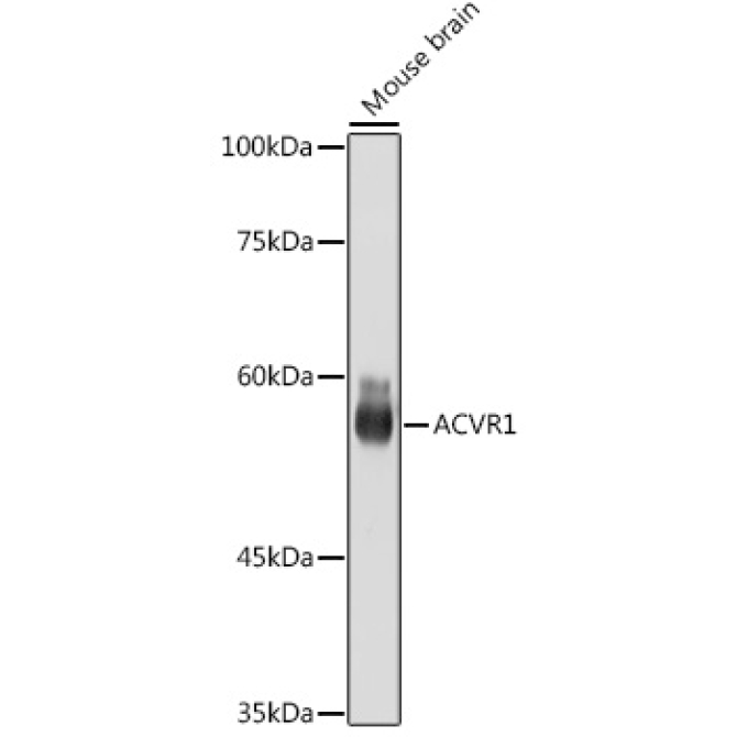 ACVR1 Rabbit Monoclonal Antibody