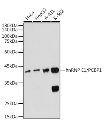 hnRNP E1/PCBP1 Rabbit Monoclonal Antibody