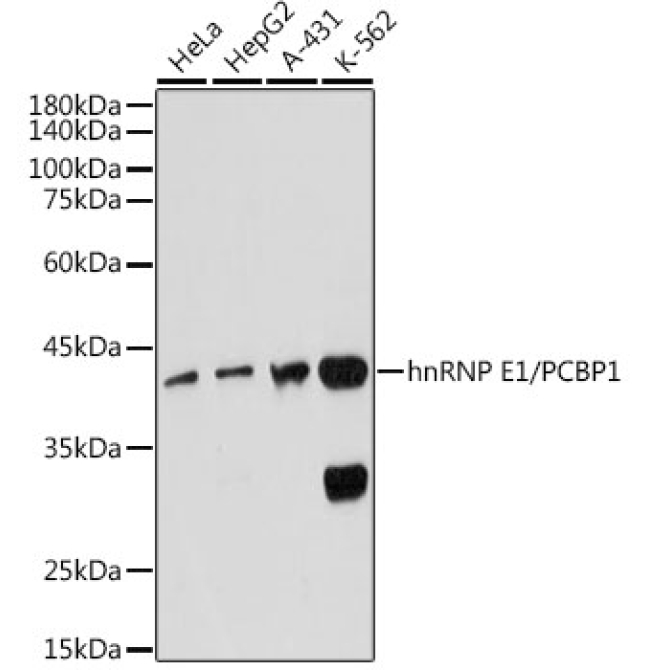 hnRNP E1/PCBP1 Rabbit Monoclonal Antibody