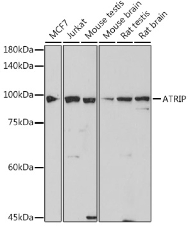 ATRIP Rabbit Monoclonal Antibody