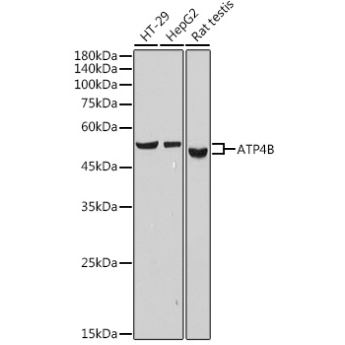 ATP4B Rabbit Monoclonal Antibody