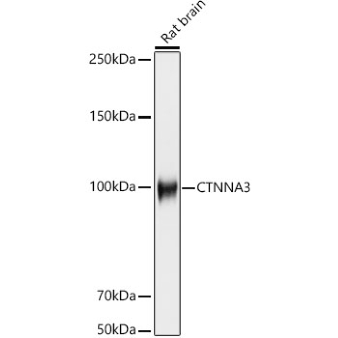 CTNNA3 Rabbit Monoclonal Antibody