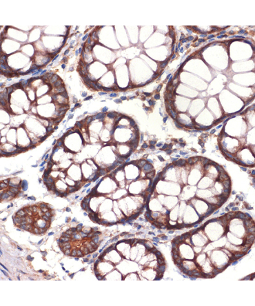 CC2D1A Rabbit Monoclonal Antibody