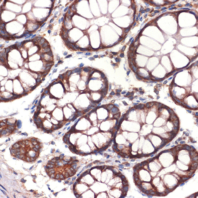 CC2D1A Rabbit Monoclonal Antibody