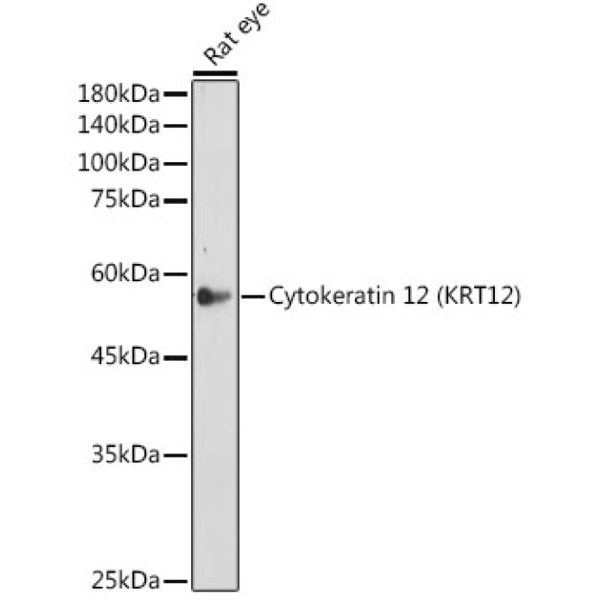 Cytokeratin 12 (KRT12) Rabbit Monoclonal Antibody