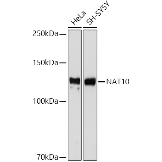 NAT10 Rabbit Monoclonal Antibody