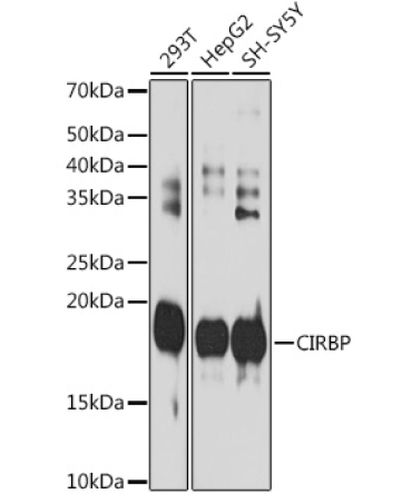 CIRBP Rabbit Monoclonal Antibody