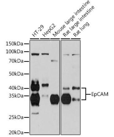 EpCAM Rabbit Monoclonal Antibody