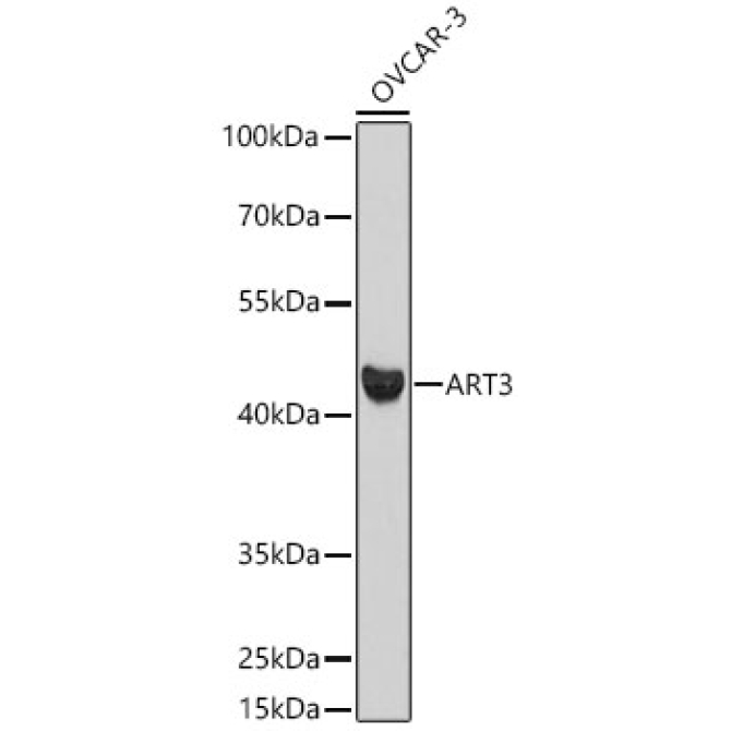 ART3 Rabbit Polyclonal Antibody