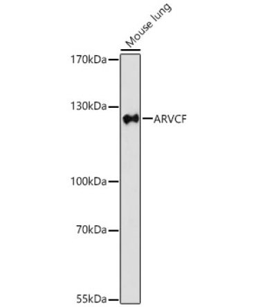 ARVCF Rabbit Polyclonal Antibody