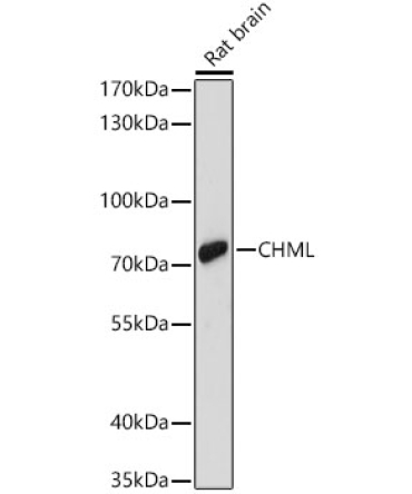 CHML Rabbit Polyclonal Antibody