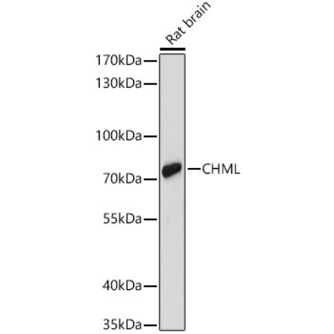 CHML Rabbit Polyclonal Antibody