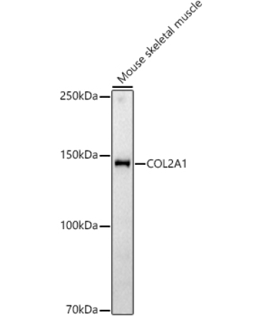 COL2A1 Rabbit Polyclonal Antibody