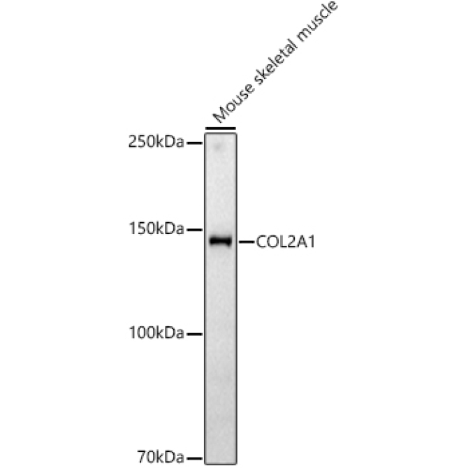 COL2A1 Rabbit Polyclonal Antibody