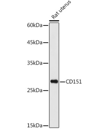 CD151 Rabbit Polyclonal Antibody