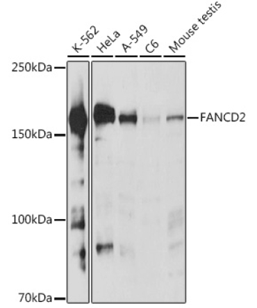 FANCD2 Rabbit Polyclonal Antibody