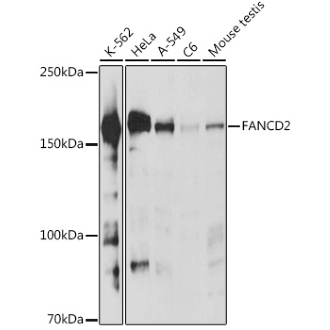 FANCD2 Rabbit Polyclonal Antibody