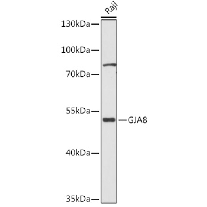 GJA8 Rabbit Polyclonal Antibody