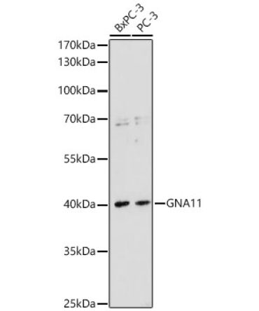 GNA11 Rabbit Polyclonal Antibody