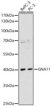 GNA11 Rabbit Polyclonal Antibody
