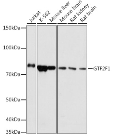 GTF2F1 Rabbit Polyclonal Antibody