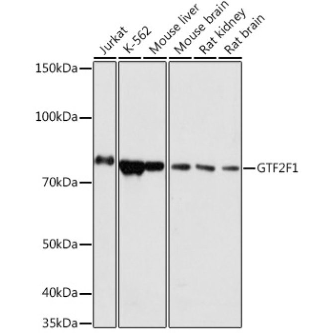 GTF2F1 Rabbit Polyclonal Antibody