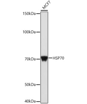 HSP70 Rabbit Polyclonal Antibody
