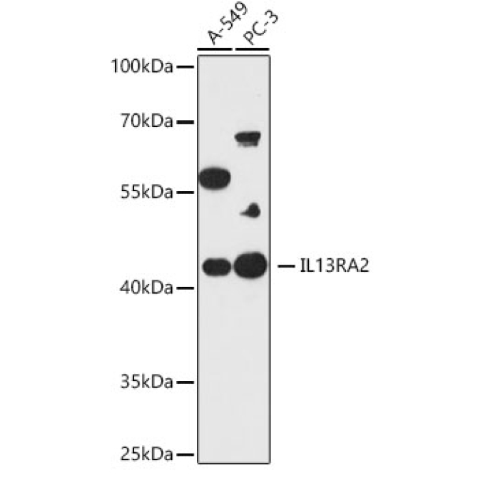 IL13RA2 Rabbit Polyclonal Antibody
