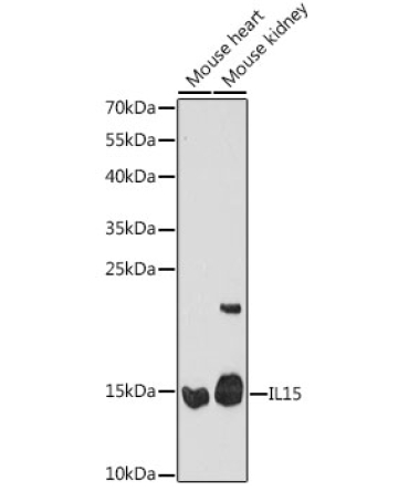 IL15 Rabbit Polyclonal Antibody