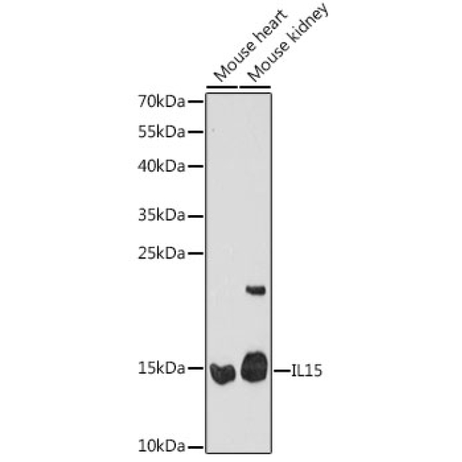 IL15 Rabbit Polyclonal Antibody