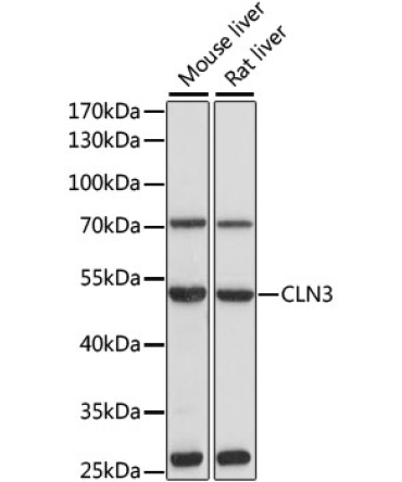 CLN3 Rabbit Polyclonal Antibody