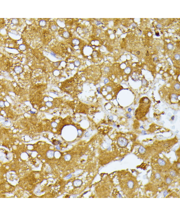 ITPR2 Rabbit Polyclonal Antibody