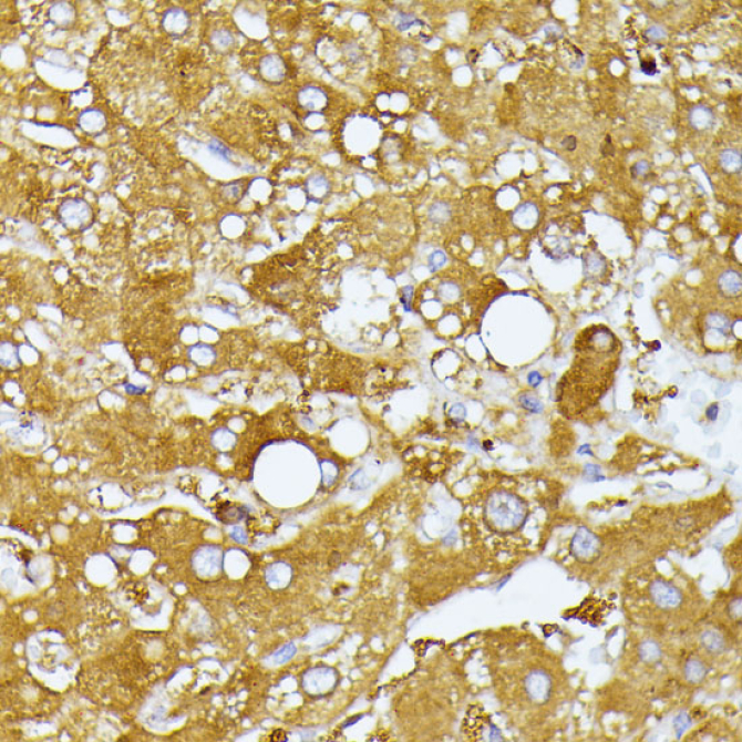 ITPR2 Rabbit Polyclonal Antibody