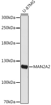 MAN2A2 Rabbit Polyclonal Antibody