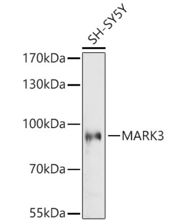 MARK3 Rabbit Polyclonal Antibody
