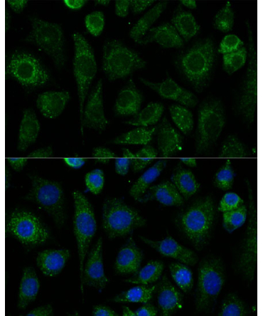 NDUFAB1 Rabbit Polyclonal Antibody
