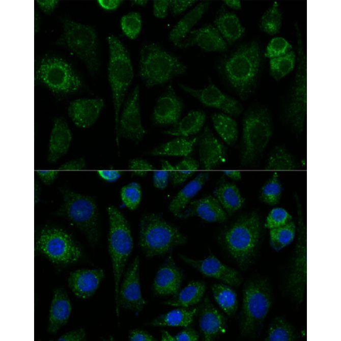 NDUFAB1 Rabbit Polyclonal Antibody