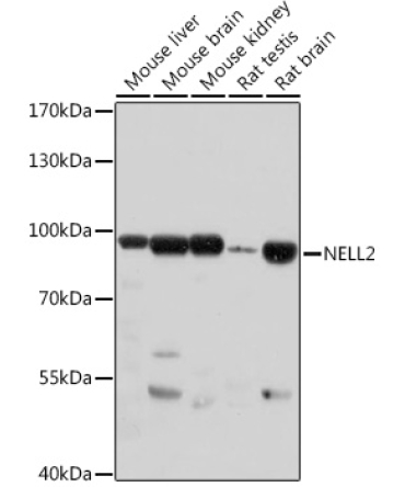 NELL2 Rabbit Polyclonal Antibody