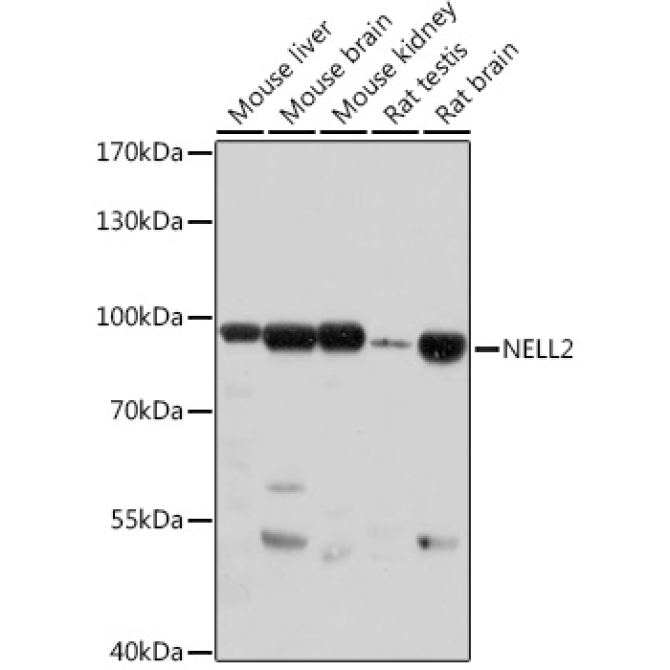 NELL2 Rabbit Polyclonal Antibody