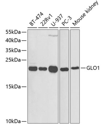 GLO1 Rabbit Polyclonal Antibody