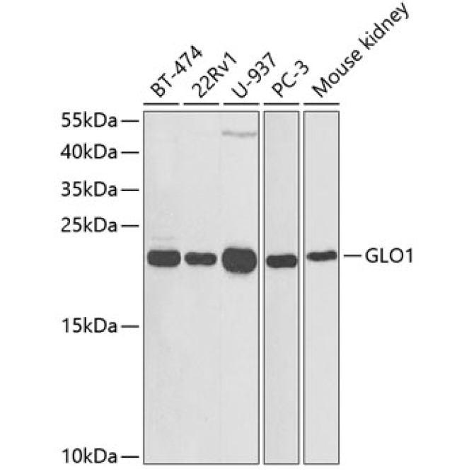 GLO1 Rabbit Polyclonal Antibody