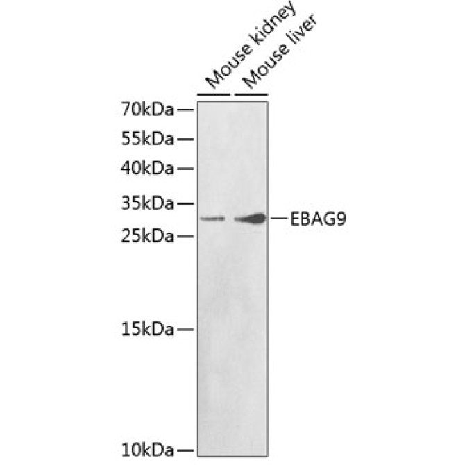 EBAG9 Rabbit Polyclonal Antibody