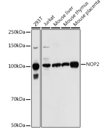 NOP2 Rabbit Polyclonal Antibody