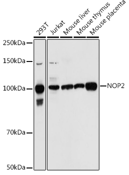 NOP2 Rabbit Polyclonal Antibody